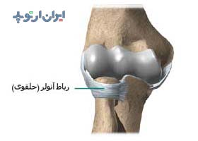 آناتومی آرنج. رباط ها