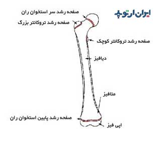 شکستگی صفحه رشد در بچه ها 2 صفحه رشد