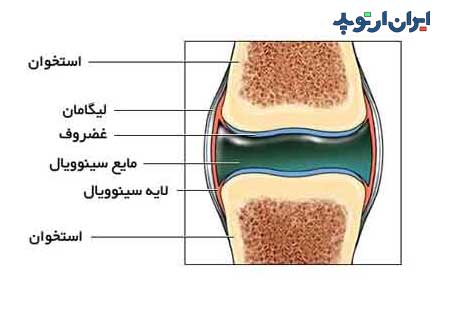 مفصل