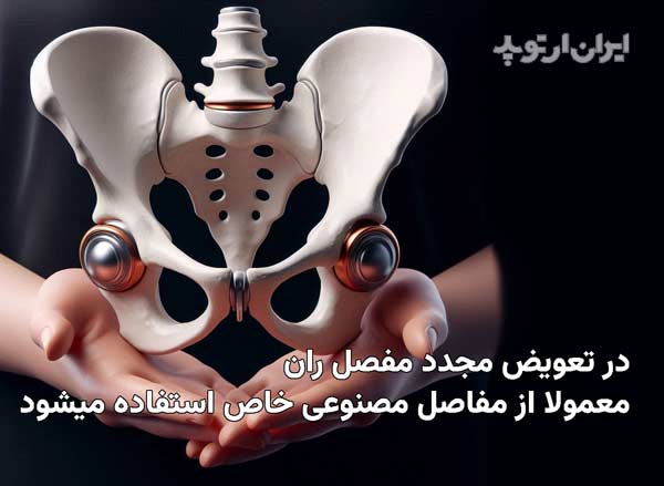 در تعویض مجدد مفصل مصنوعی معمولا از مفاصل خاص استفاده میشود