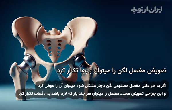 تکرار تعویض مجدد جراحی تعویض مفصل