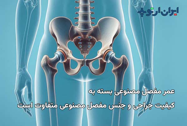 عمر مفصل مصنوعی بستگی به کیفیت جراحی و نوع مفصل دارد