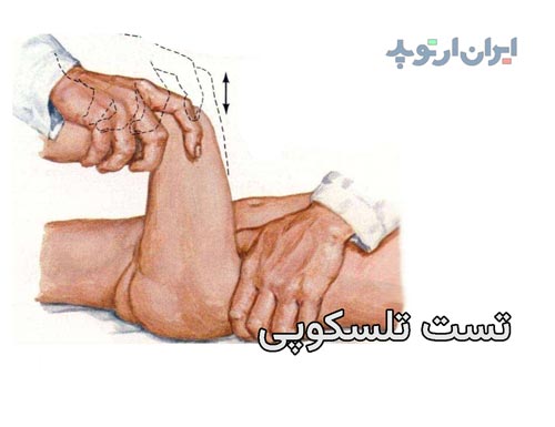 عکس دررفتگی لگن نوزاد. تست تلسکوپی برای تشخیص دررفتگی مادرزادی لگن و مفصل ران در کودکان