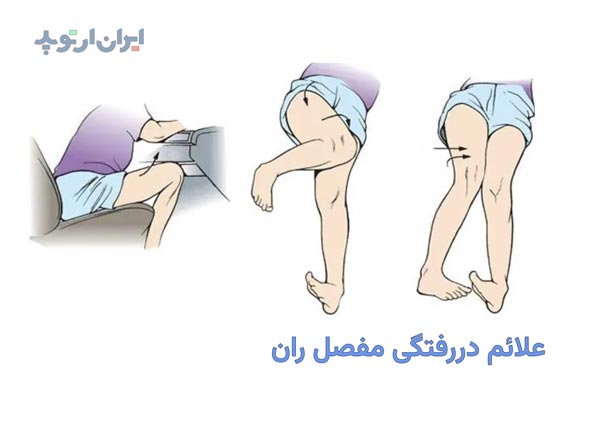 علائم دررفتگی لگن چیست