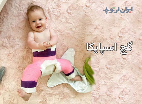 استفاده از گچ گیری اسپایکا برای نگه داشتن مفصل ران بعد از جاانداختن دررفتگی لگن