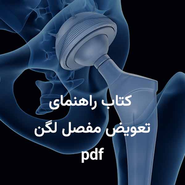 راهنمای تعویض مفصل ران