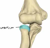 دررفتگی مفصل آرنج چیست. علائم و درمان 3 سر استخوان رادیوس در آرنج