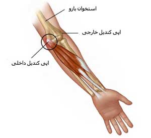 گلف البو یا آرنج گلف بازان