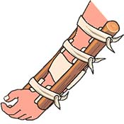 دو روش مختلف بستن ساعد و مچ دست با استفاده از آتل