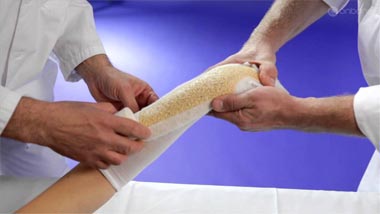 مراحل درمان شکستگی