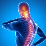 اسپوندیلیت انکیلوزان