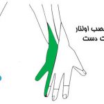 عصب اولنار