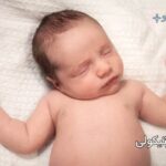 تورتیکولی یا کجی گردن چیست