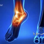 آناتومی مچ پا