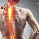 اسکولیوز چیست