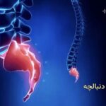 علت درد دنبالچه و درمان آن