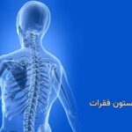 فیوژن ستون فقرات