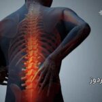 گودی کمر و لوردوز