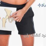 علت درد لگن در ناحیه کشاله ران چیست