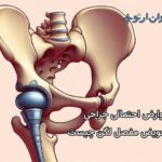 عوارض احتمالی جراحی تعویض مفصل در ناحیه لگن چیست