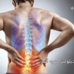 اسپوندیلولیز مهره کمر