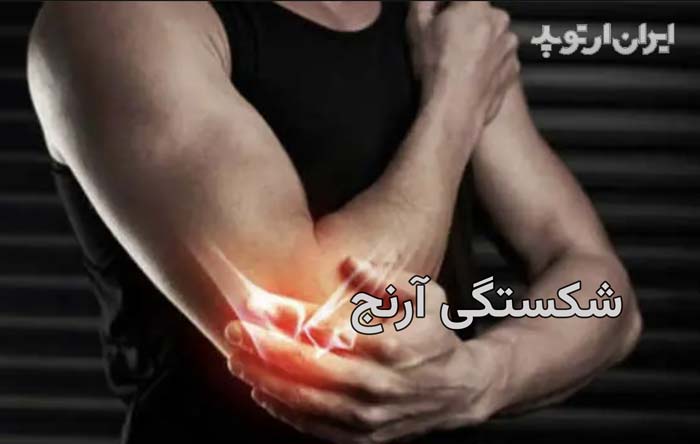 شکستگی آرنج بالغین. انواع و درمان 1 شکستگی آرنج
