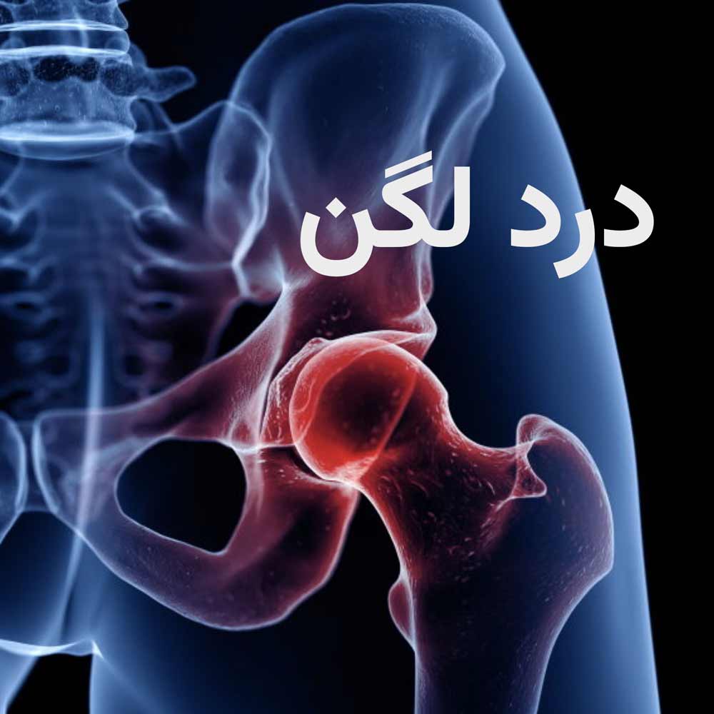 درد لگن. درد استخوان لگن